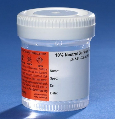 Biopsy Containers