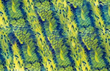 Alcian Yellow Toluidine Blue